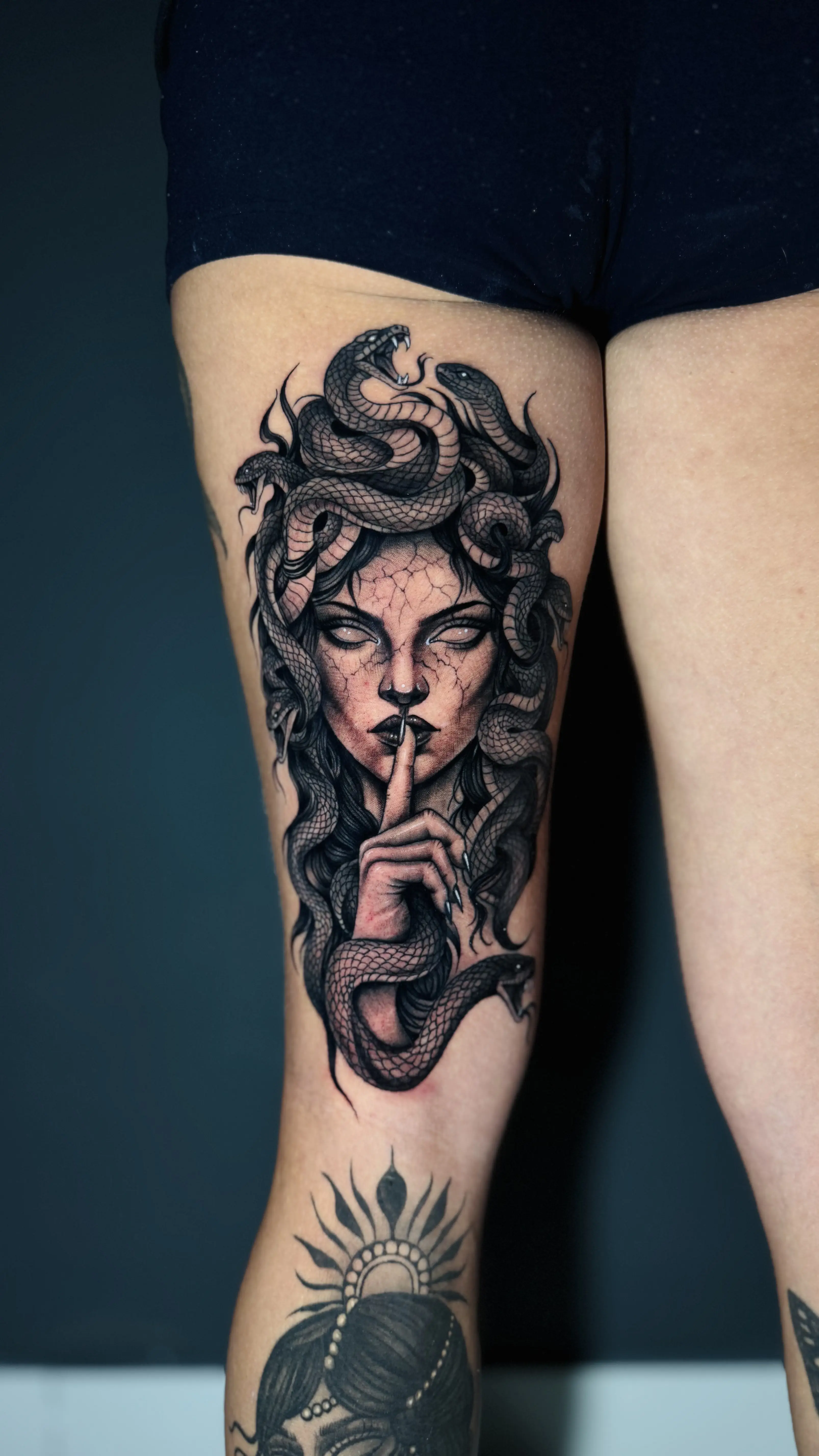 Medusa 